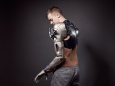 Amputee Gamer Receives Bionic Arm